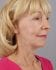 Face Lift Patient 23 - After Thumbnail 