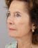Face Lift Patient 24 - Before Thumbnail 